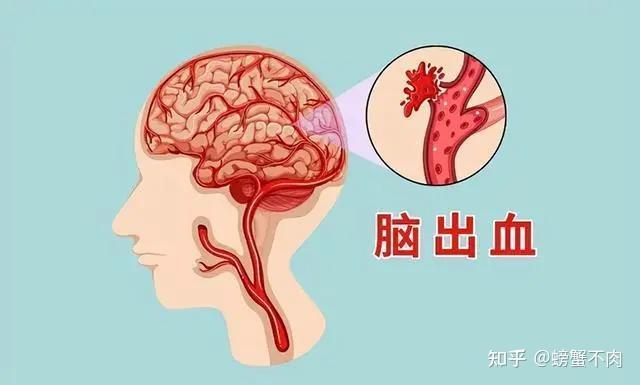 高血压的危害你注意了吗？